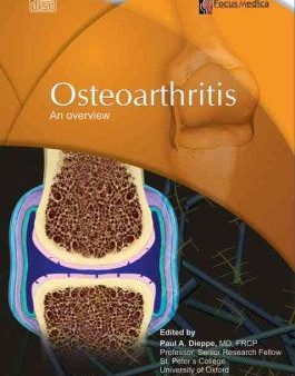 Osteoarthritis Online